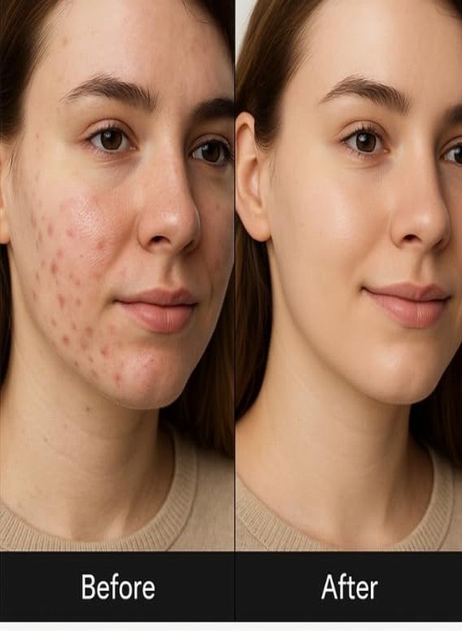 Iguana 2% Kojic Acid + 1% Alpha Arbutin Serum | Brightening Facial Serum for Dark Spots & Uneven Skin Tone | Skin Glow Booster | 30 ml (1 fl oz) - Image 4